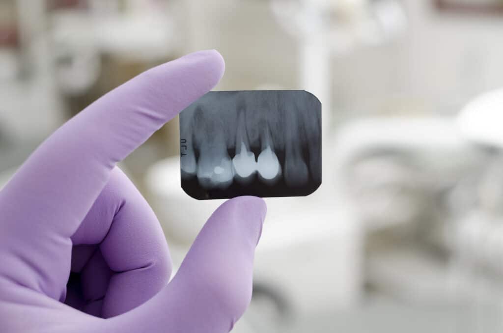 Doctor holding and looking at a dental x-ray