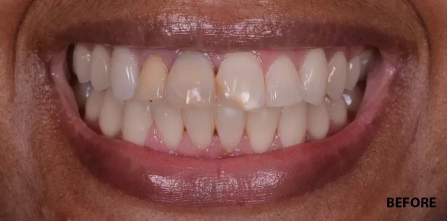 Before treatment photo