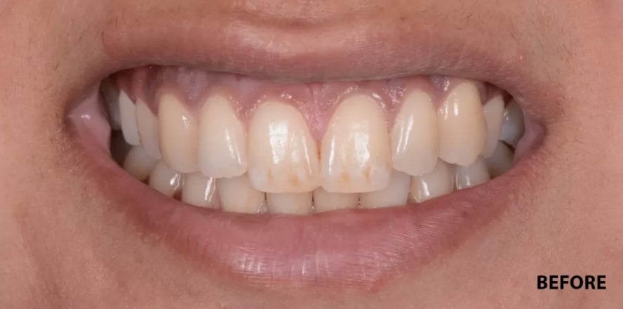 Before treatment photo