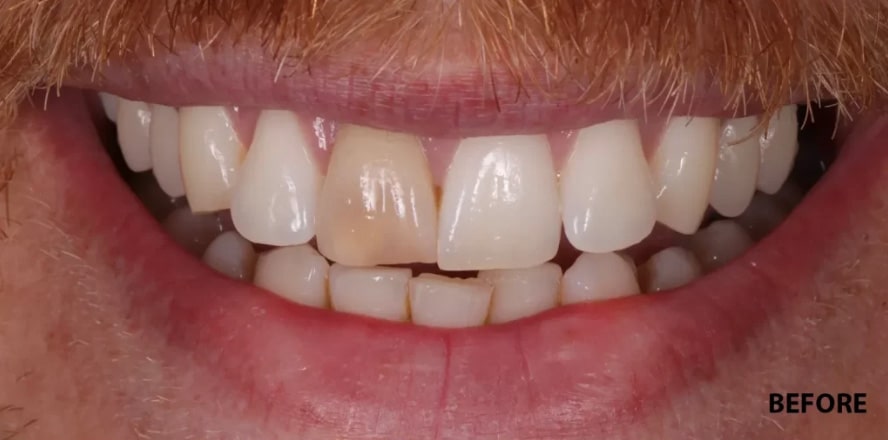 Before treatment photo