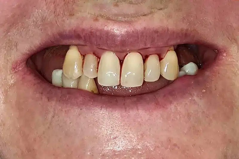 Women Smile