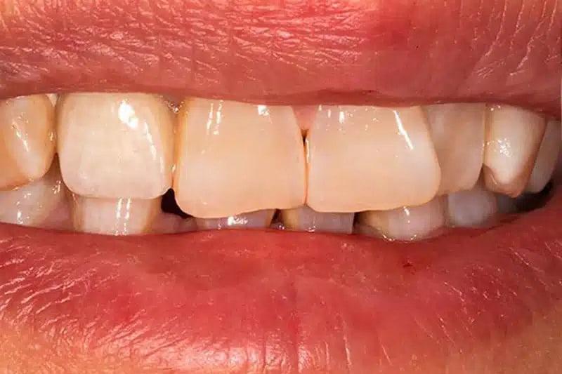 Man Smiling