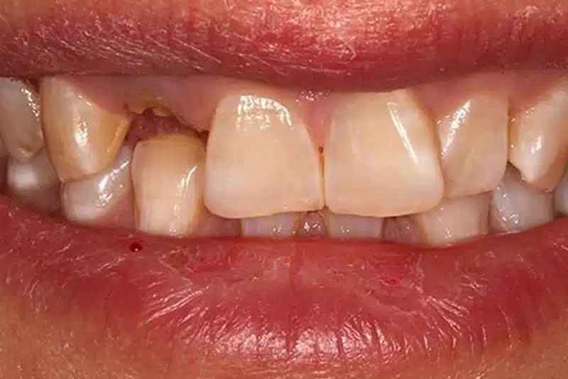 Man Smiling