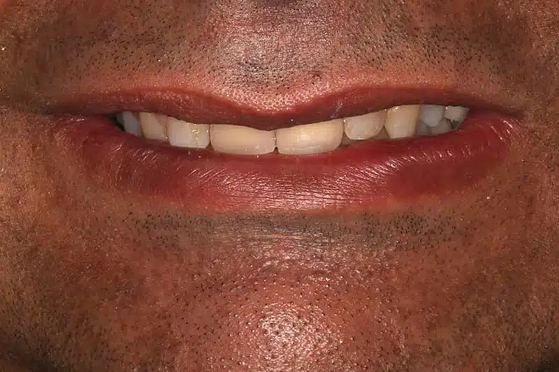 Man Smile