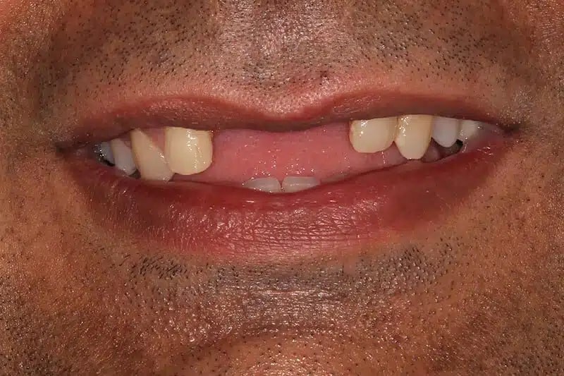 Man Smile