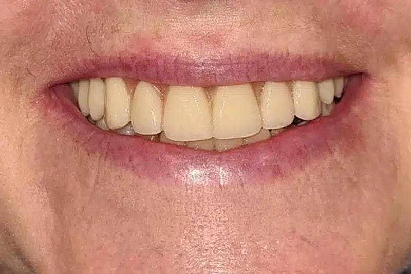 Women Smile